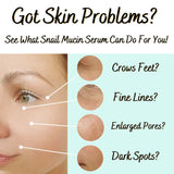Snail Mucin Serum with Vitamin C & E